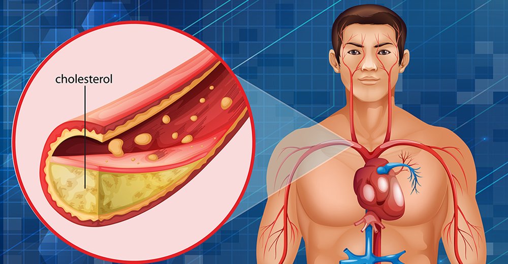 lower cholesterol