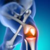 BONE  HEALTH