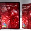 img-2 CEREBROVASCULAR  DISEASE
